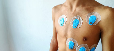 The boy was fitted with suction cups to connect him to a 24-hour heart monitoring machine. The...