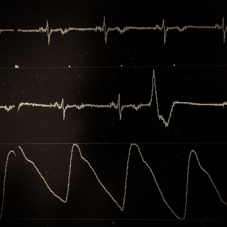 Heart monitor screenの写真素材