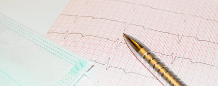 Heart rate result graph paper document electrocardiogram and pen on it, analysis of medical research resultsの写真素材