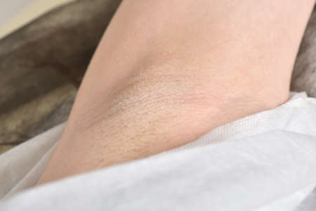 Female armpit with hair before depilation. Beauty and skin care concept.の写真素材