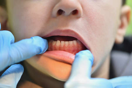 Dentist looks at healthy teeth of a child, close-upの写真素材