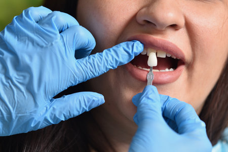 Dentist checks the color match of the enamel of the teeth after whiteningの写真素材