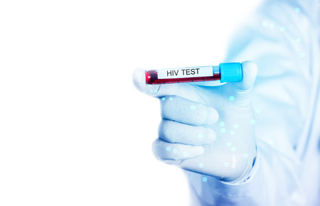 Doctor holding Blood sample with HIV testの写真素材