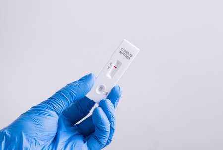 Positive result of coronavirus COVID-19 test.