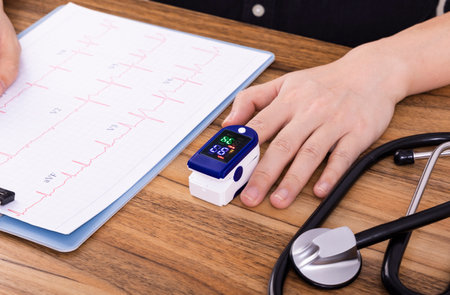 Close-up of cardiogram and stethoscope on tableの写真素材