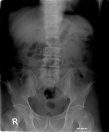 abdomen tomographyの写真素材