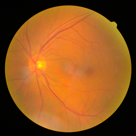 retinalの写真素材