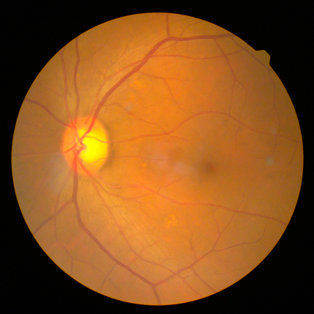 retinalの写真素材