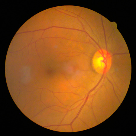 retinalの写真素材