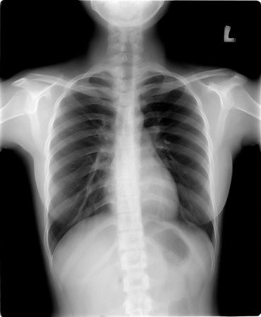chest x-rayの写真素材