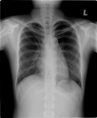 chest x-rayの写真素材