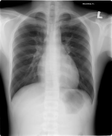 chest x-rayの写真素材