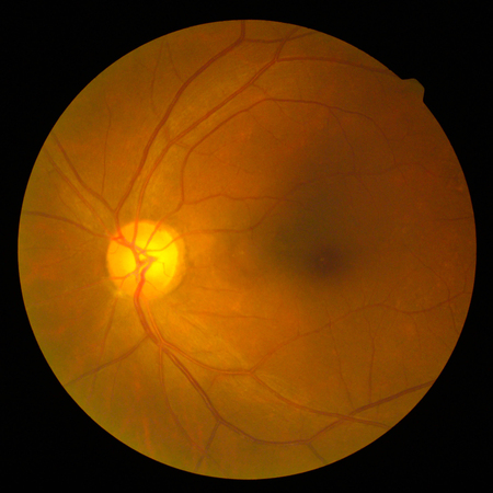 Retinalの写真素材