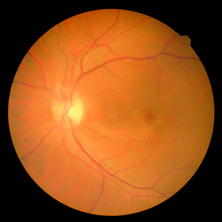 retinalの写真素材