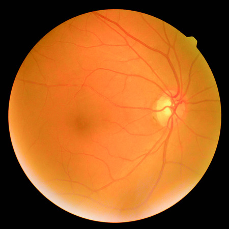 retinalの写真素材