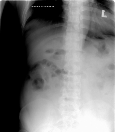 abdomen tomographyの写真素材