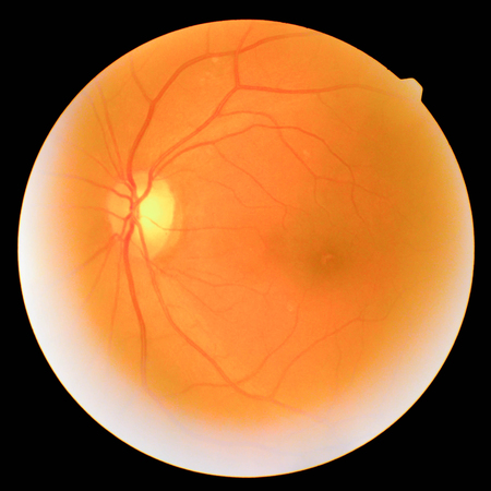 retinalの写真素材