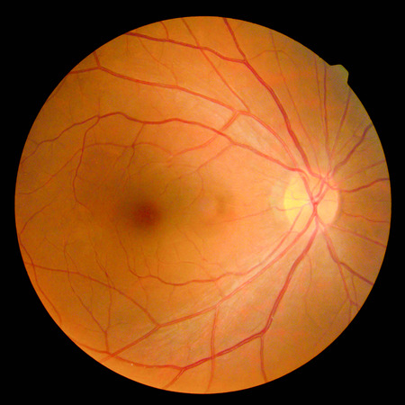 retinalの写真素材