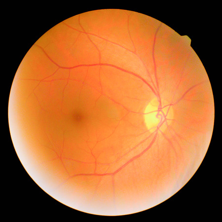 retinalの写真素材
