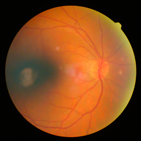 retinalの写真素材