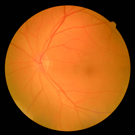 retinalの写真素材