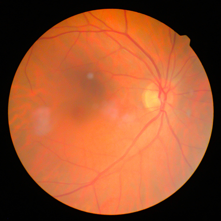 retinalの写真素材