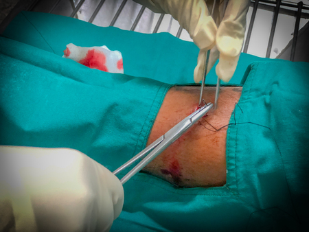 dark and blurred picture of Nursing of patients with leg stitches that are sharp cutting. In the night.の写真素材