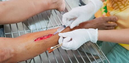 Hospital staff treating the patient by injection, clean the wound and stitches to patients. at Health Promoting Hospital District. The patient's injuries were cuts.の写真素材