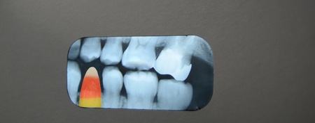Candy corn in dental xray.