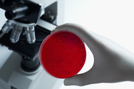Scientist with blood cell culture dish and microscope in laboratory selective focus 