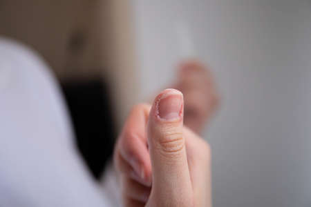 nail care. the girl sharpens her nails with a nail file. a broken nail. girl takes care of manicure...