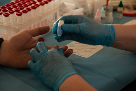 donor's day. a nurse in blue latex gloves takes a blood sample from a patient. medical blood jars....