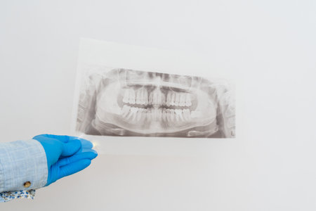 View on a radiography of the jaw. Dental x-ray of pacient oral cavity with teethの写真素材