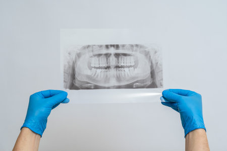 A Jaw radiography image. Dental x-ray of pacient oral cavity with teethの写真素材