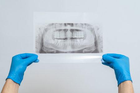 A Jaw radiography image. Dental x-ray of pacient oral cavity with teethの写真素材