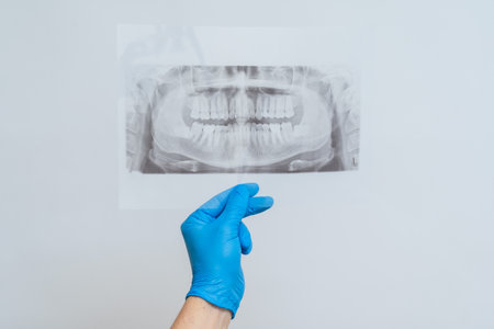 A Jaw radiography image. Dental x-ray of pacient oral cavity with teeth