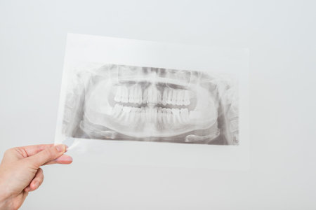 View on a radiography of the jaw. Dental x-ray of pacient oral cavity with teethの写真素材