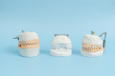 Model of teeth and gums on a blue background. Dental conceptの写真素材