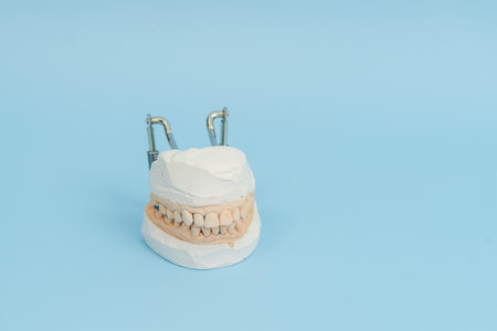 Study model of teeth and gums. On blue background. Dental conceptの写真素材