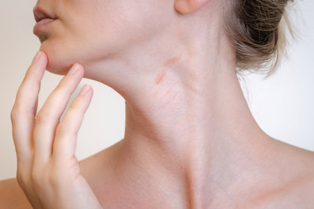 View on a woman's neck with red spots isolated. Atopic dermatitis, psoriasis or eczema, inflammatory...