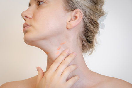View on a woman's neck with red spots isolated. Atopic dermatitis, psoriasis or eczema, inflammatory or allergiesの写真素材