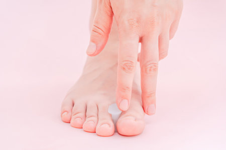 Close up of foot with Valgus Big Bunion toe corrector. Orthopedic silicone supportの写真素材