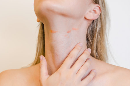 View on a woman's neck with red spots isolated. Atopic dermatitis, psoriasis or eczema, inflammatory or allergiesの写真素材