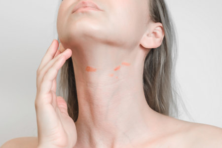 View on a woman's neck with red spots isolated. Atopic dermatitis, psoriasis or eczema, inflammatory or allergiesの写真素材