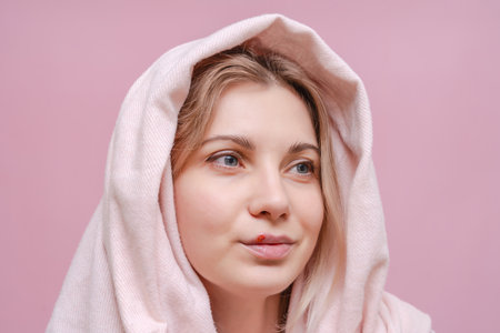 Closeup on a virus herpes on lip of young woman with scarf on her head against pink background....