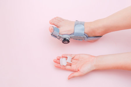 View on hallux valgus orthopedic medical thumb brace on female foot and a silicone finger separator