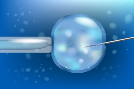 Artificial insemination in vitro fertilization. IVF macro. Test tube babyのイラスト素材