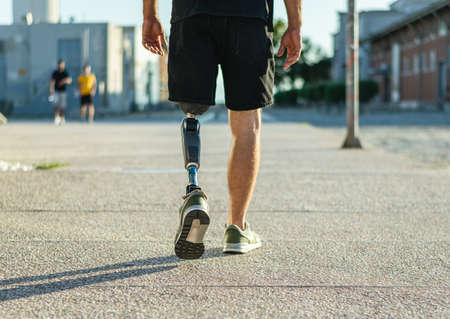 Man with prosthetic leg.の写真素材