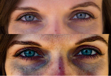 eyes of a woman before and after a rape. Stop violence against womenの写真素材
