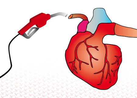 Care for a heart by a blood transfusion to a heart problemの写真素材